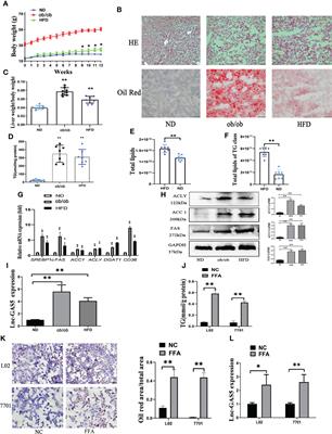 LncRNA GAS5 Knockdown Mitigates Hepatic Lipid Accumulation via Regulating MiR-26a-5p/PDE4B to Activate cAMP/CREB Pathway